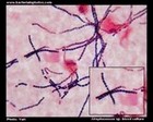 streptococcus in blood culture